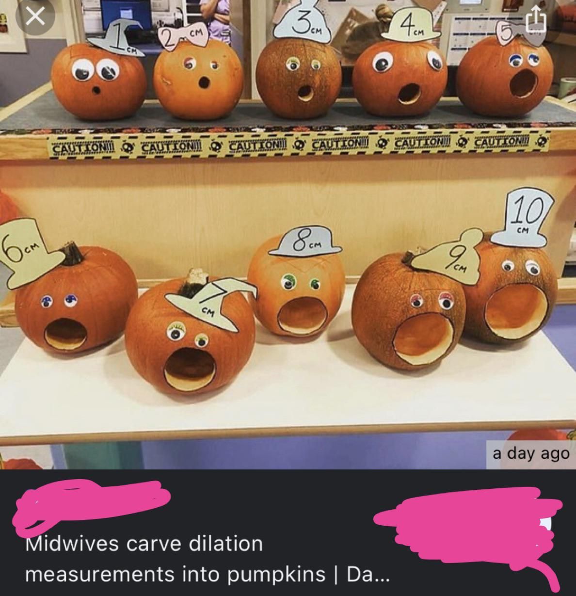 Midwives cut women’s dilation size into pumpkins for a truly horrifying sight!
