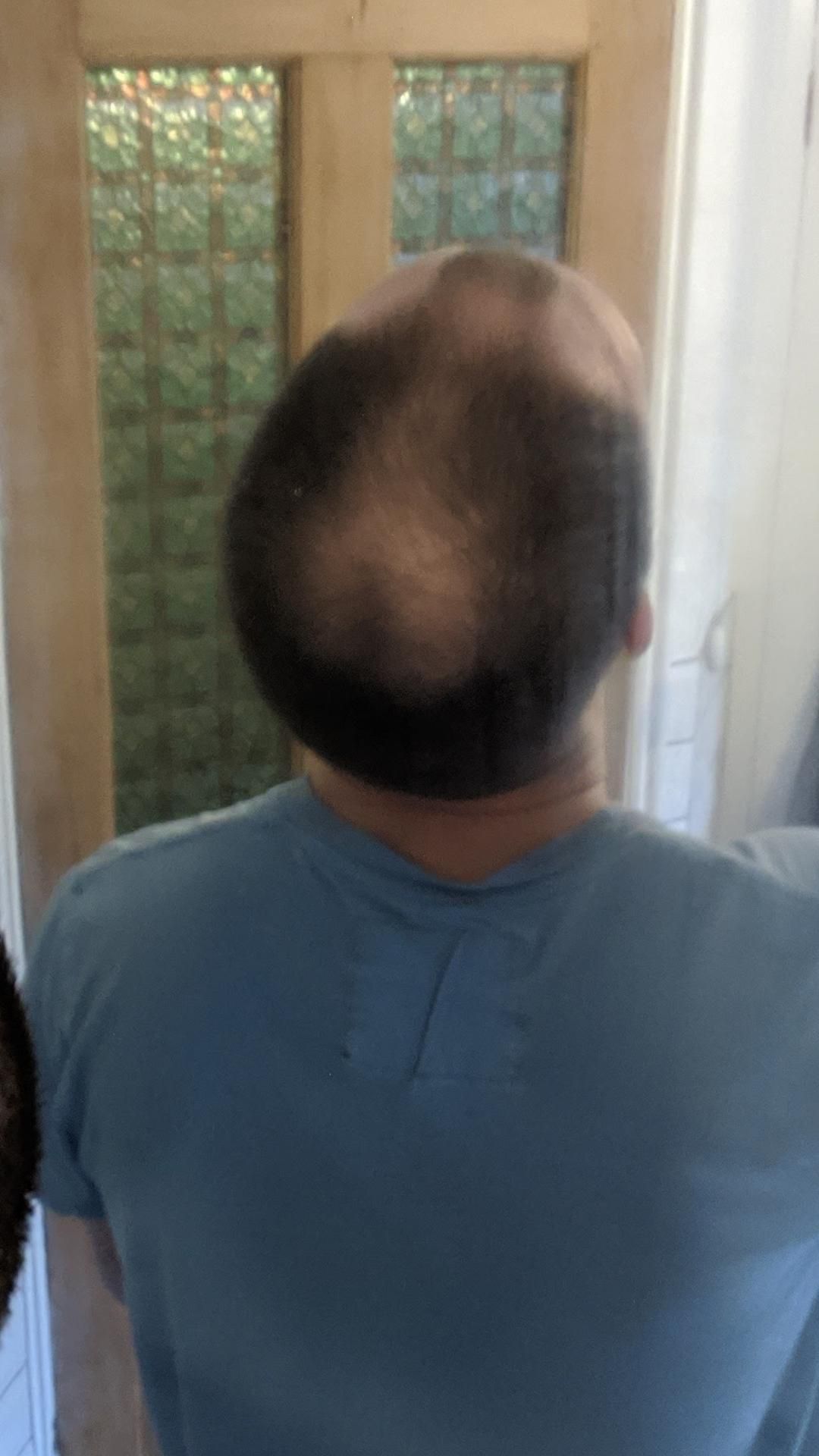 My bald spot is shaped like a *** and balls