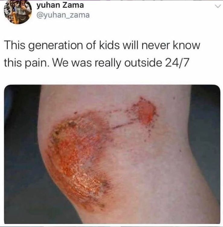 We used to get this so often