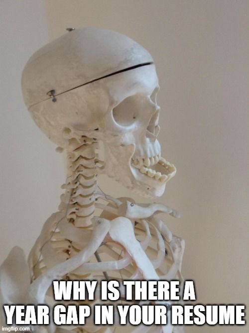 Because *** you