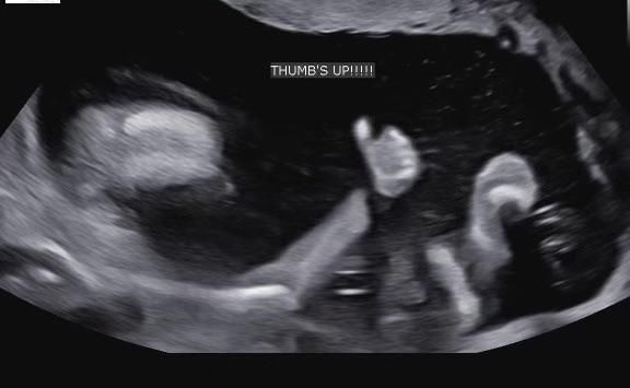 Just had our twenty week ultrasound. Kid says he’s doing fine.