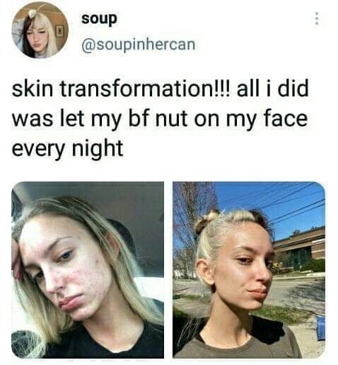 it works. how do you think solv_ has so smooth skin