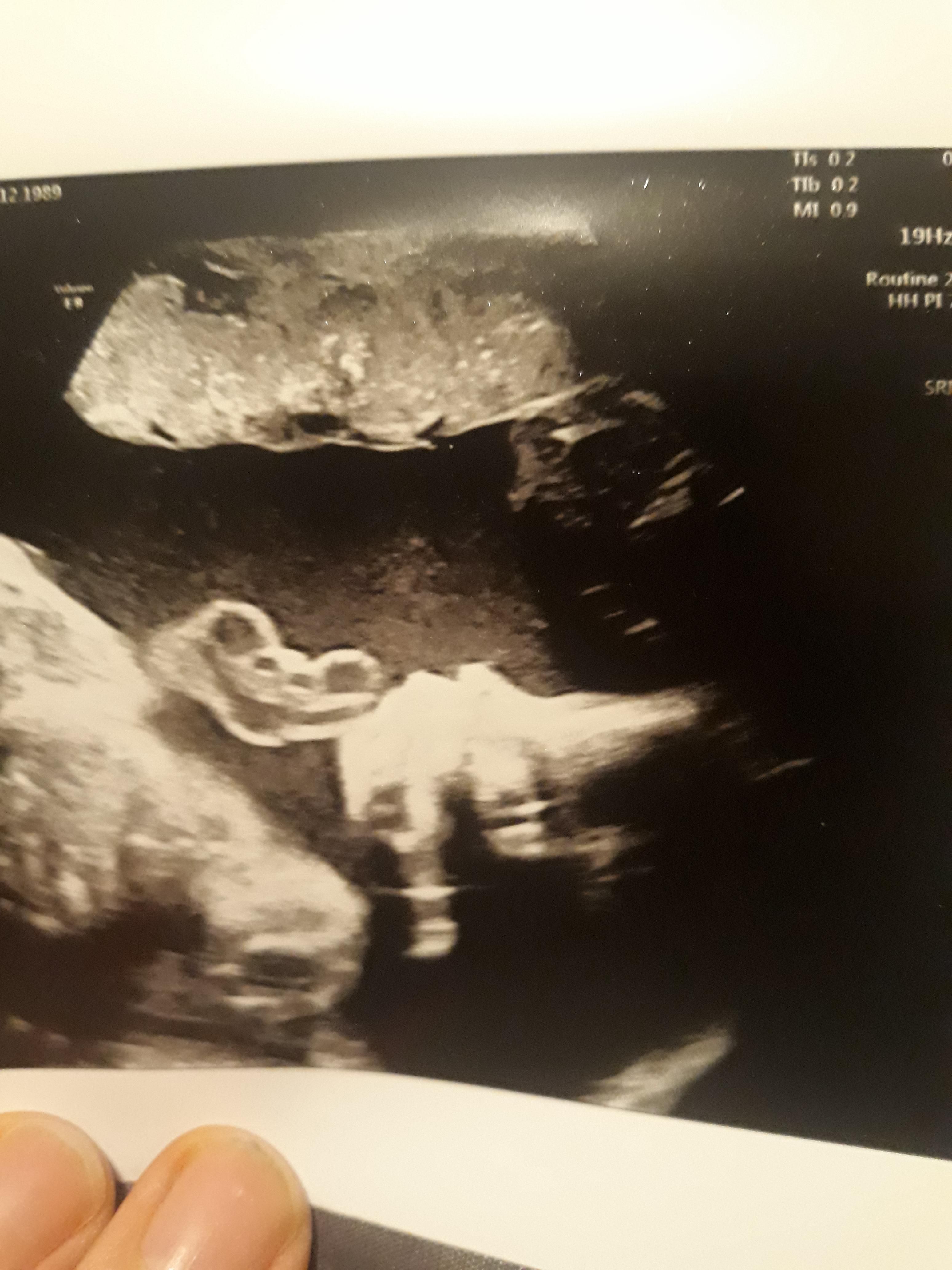 Went for a baby scan today,we already have a boy an a girl and the third is going to b a...em dinosaur?!?