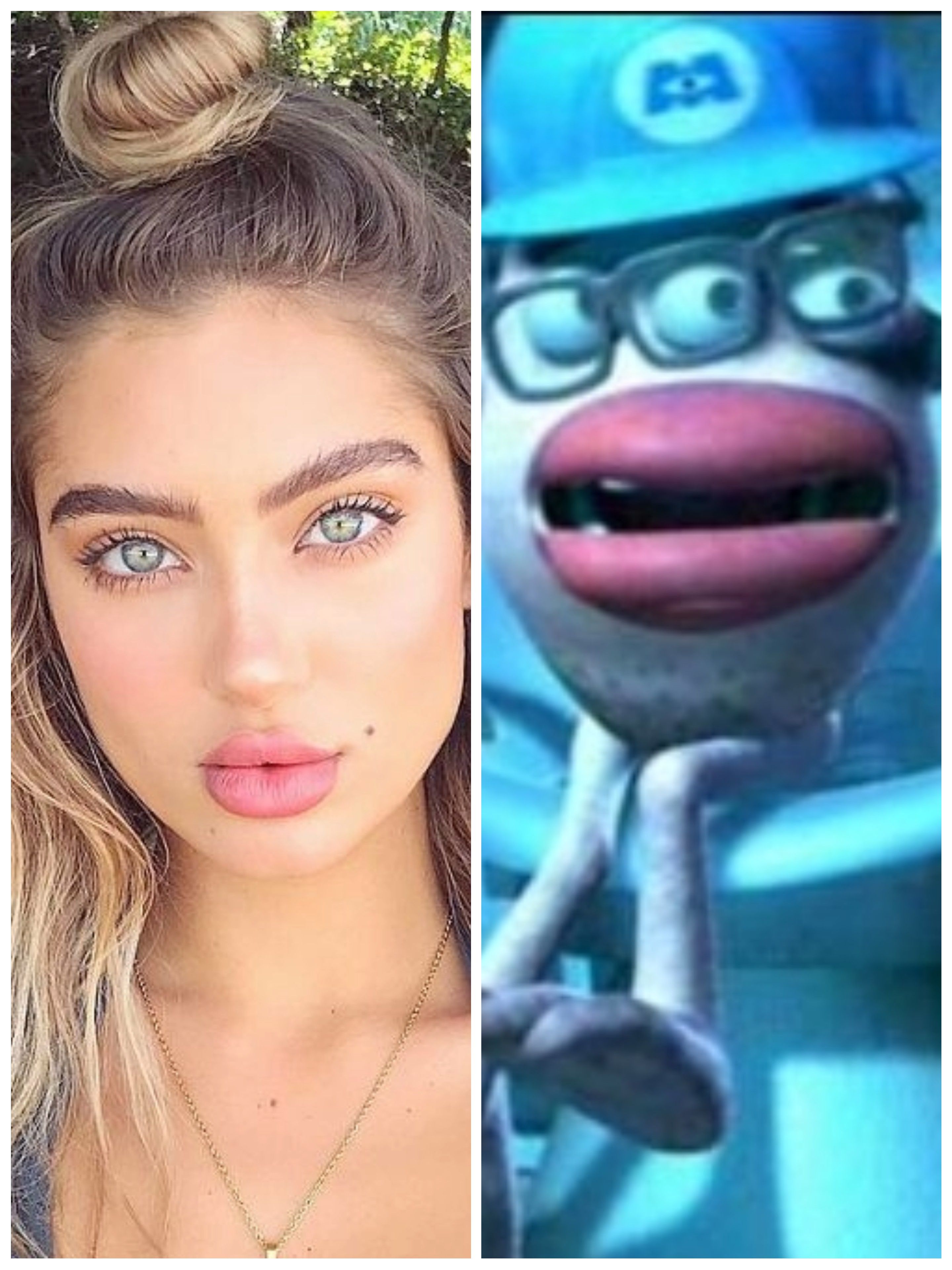 How women with lip injections think they look v.s. how they really look