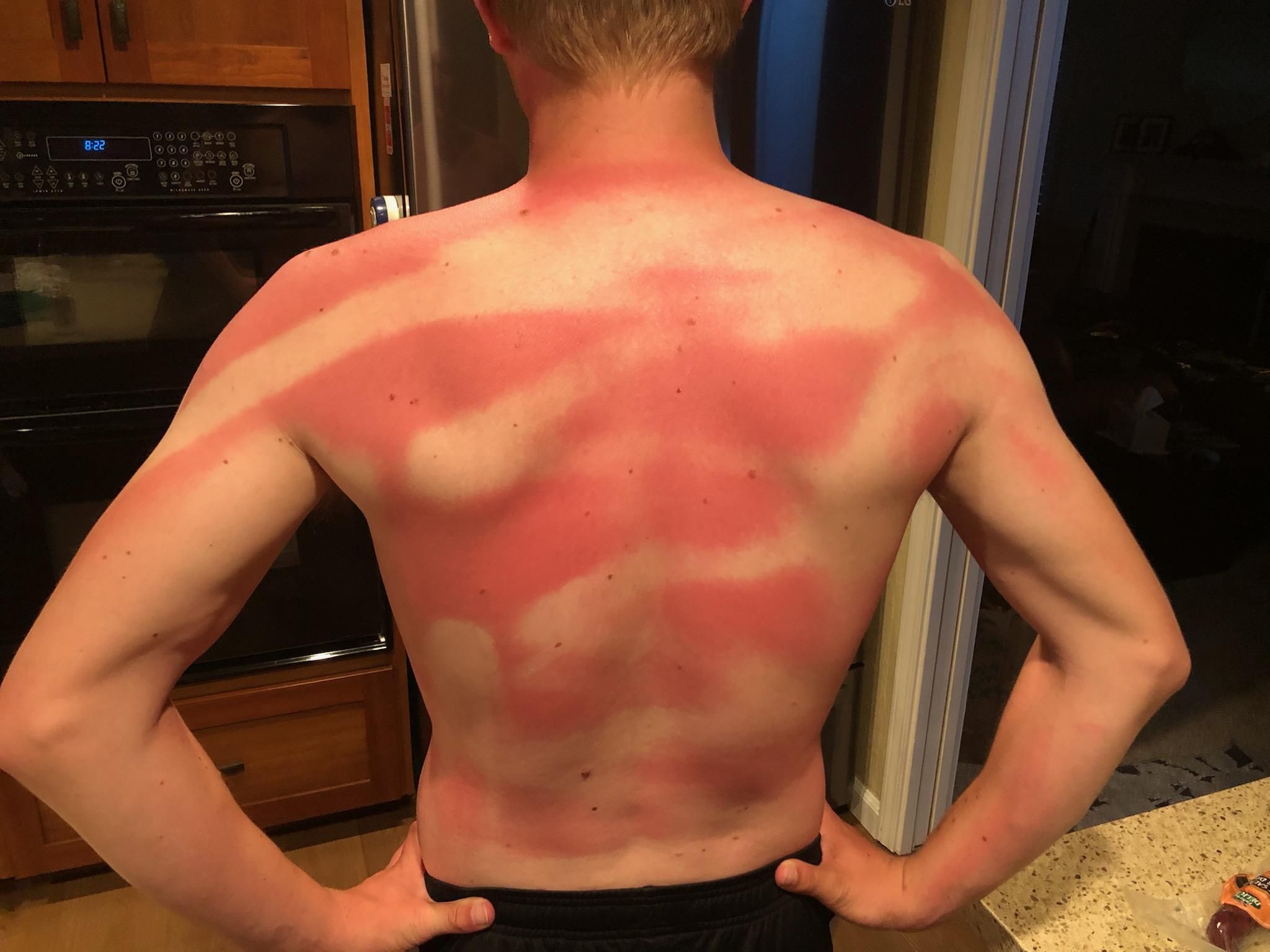 My Wife helped me sunscreen my back at beach day today !!