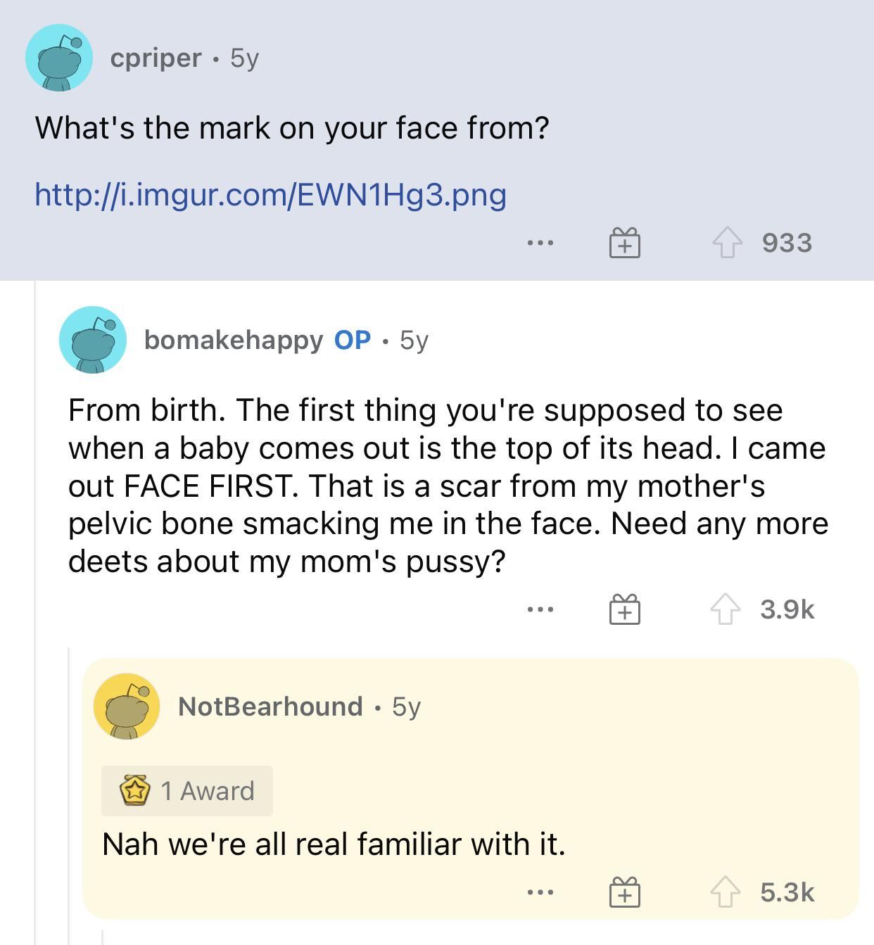 Was Googling why Bo Burnham had a mark on his face and found this gem of an exchange from an AMA he did a while back