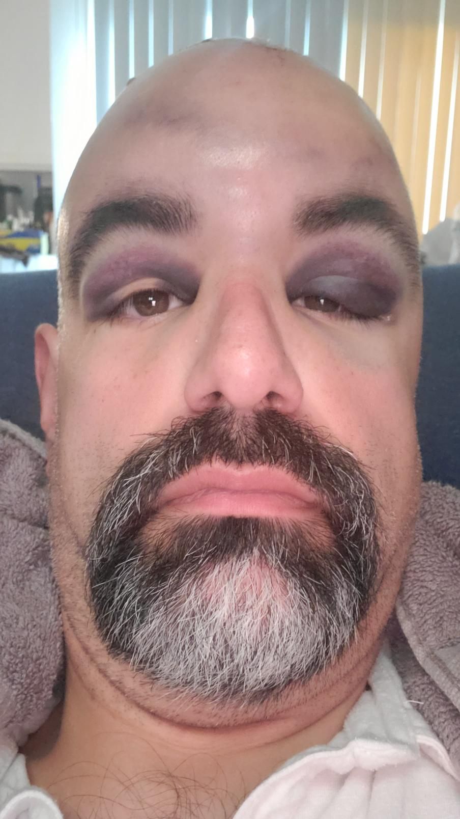 Was rear ended in a car accident this morning. Eye shadow on point.