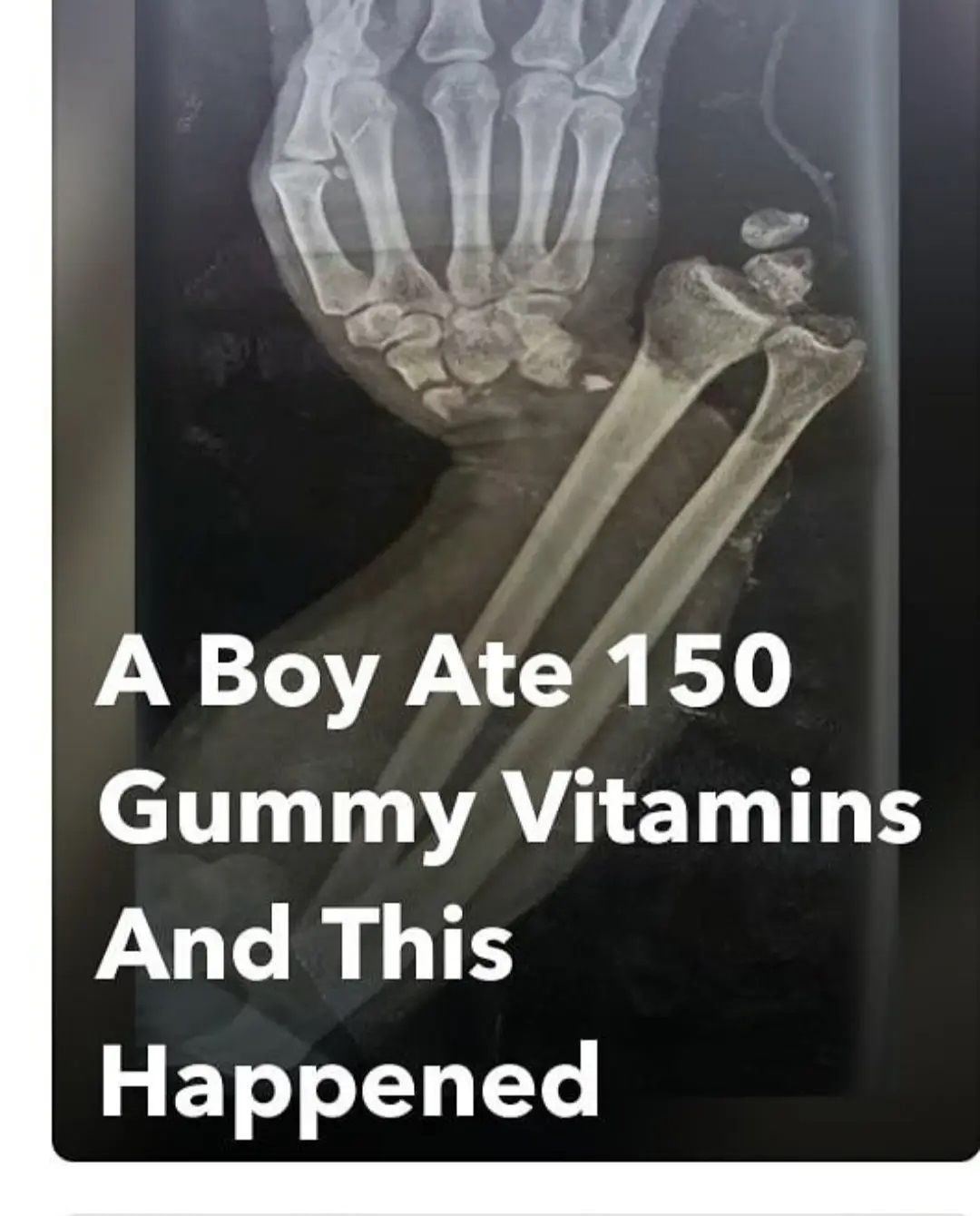 Is it broken doc? Idk bro let's make an xray