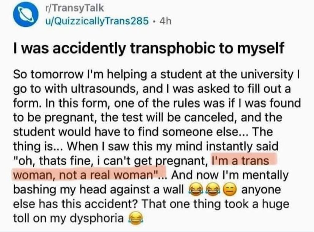 xDD