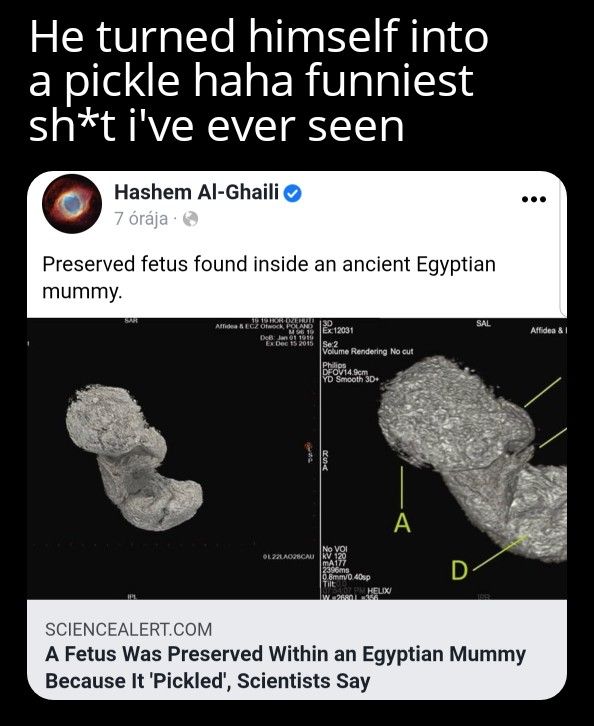 I'm pickle Raaaa
