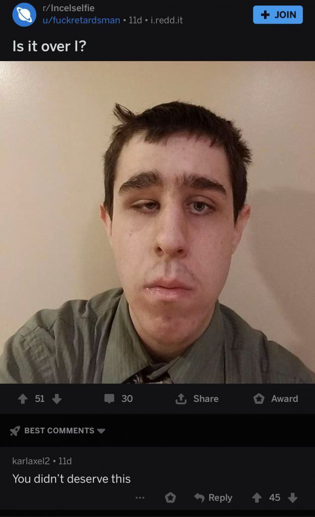 No bro you're good