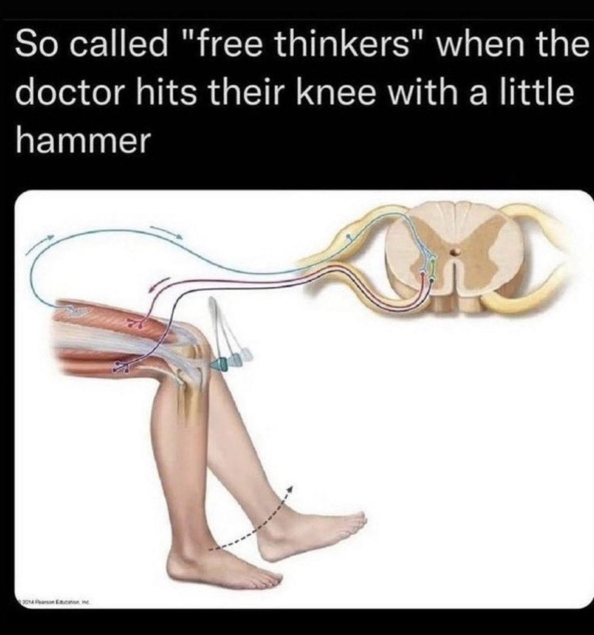 big knees