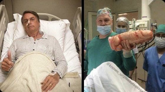 "unfortunately we could not also remove the stick"