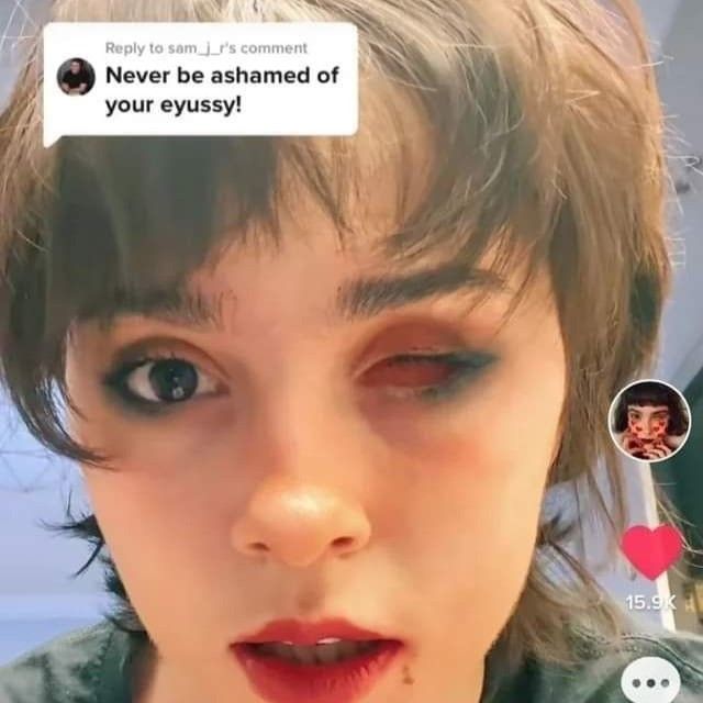 Bruh