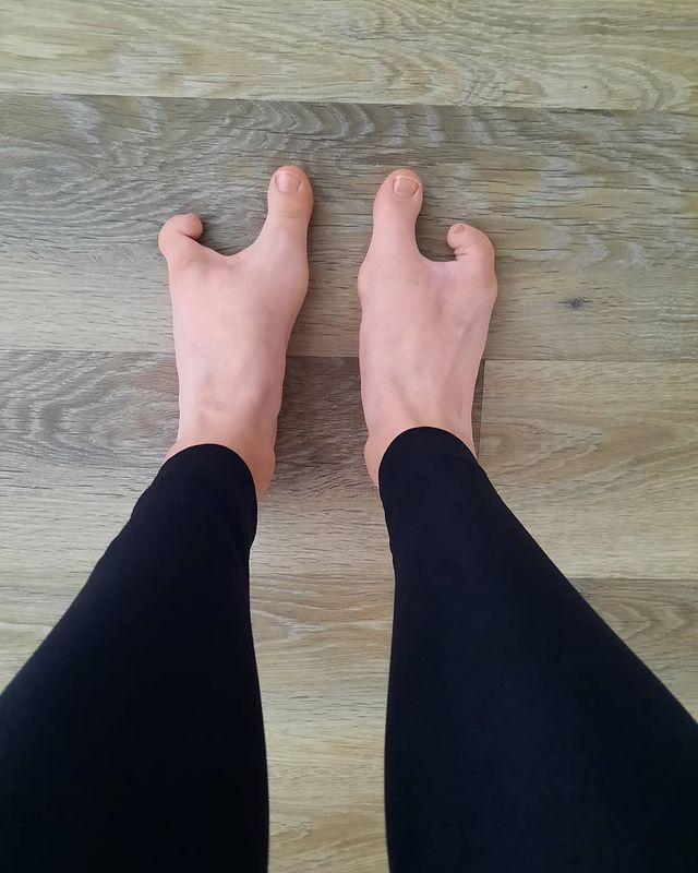Would this end a foot fetish or make it worse @you know who