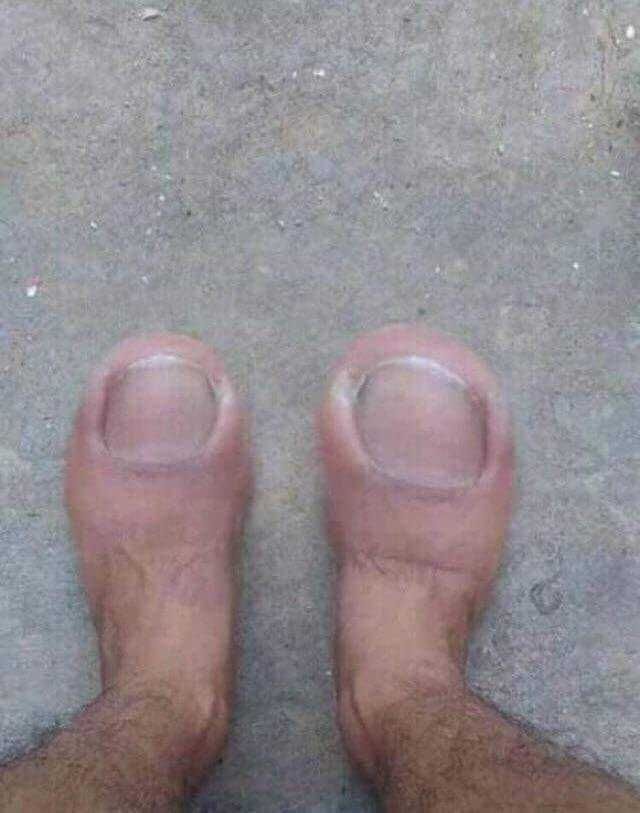 for all the feet fetishists