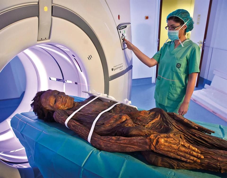 Patient burned alive after failed MRI