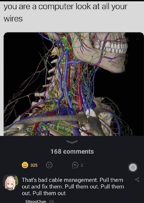 cable