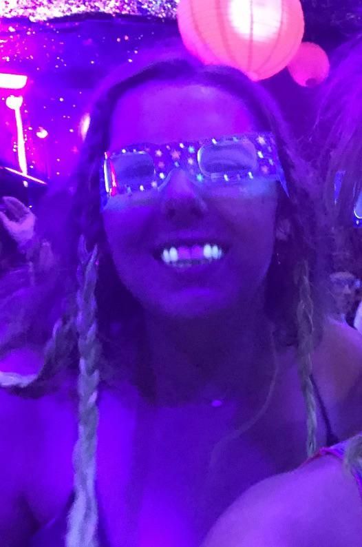 Didn’t know I’d be exposed that my two front teeth are fake at a black light party