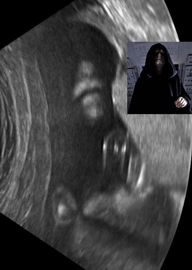 This baby was born in the dark side