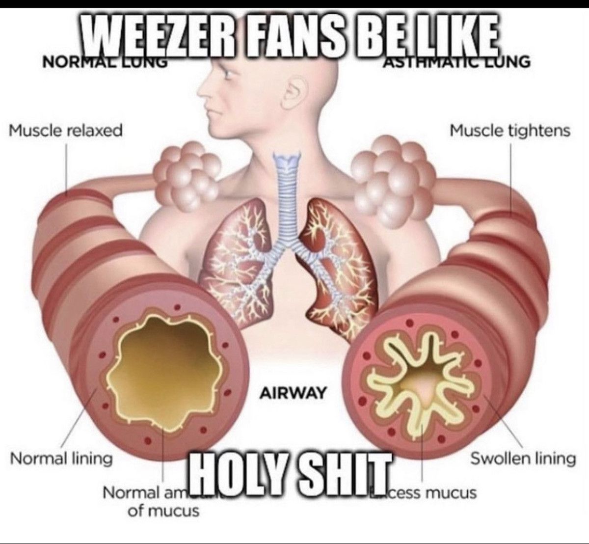 TWU
