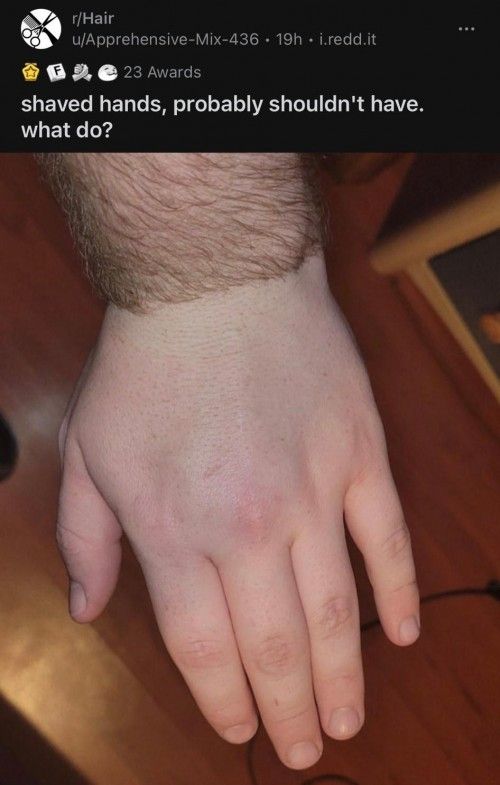 Cold hands for a while.