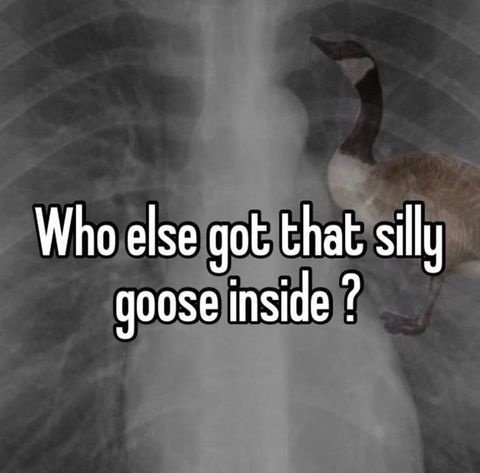I'm such a silly goose