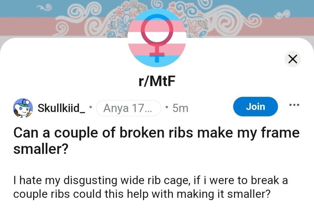 ribs