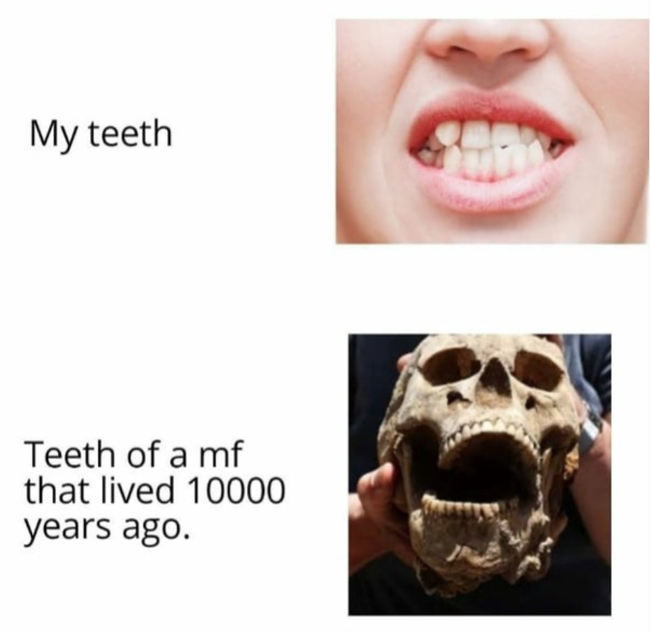 Teeth problems :(