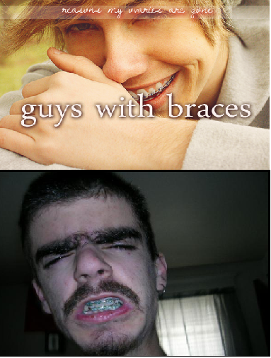 Braces are hot indeed