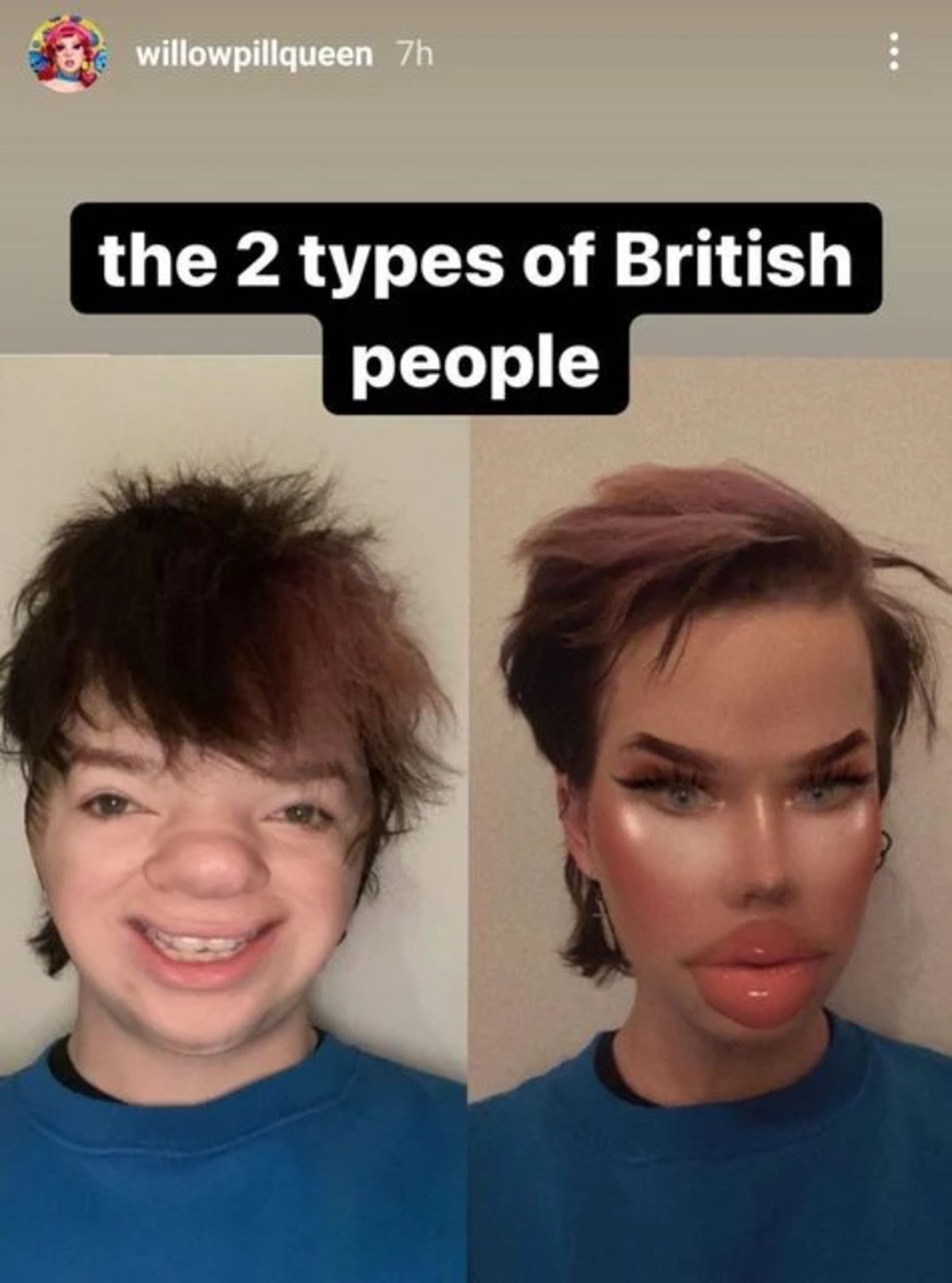 oi oi oi