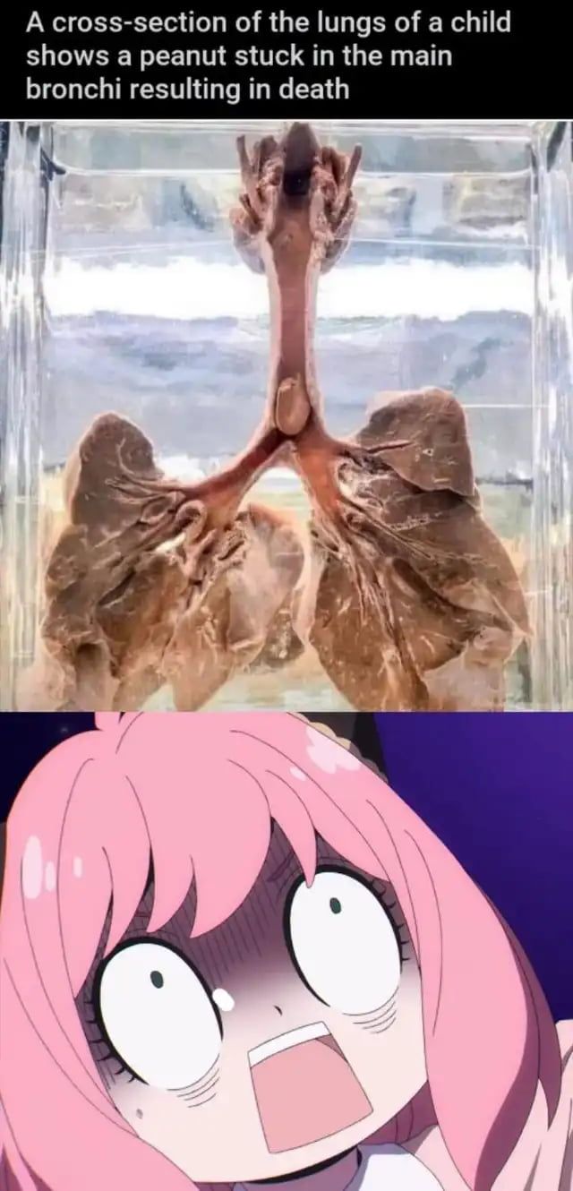 bro