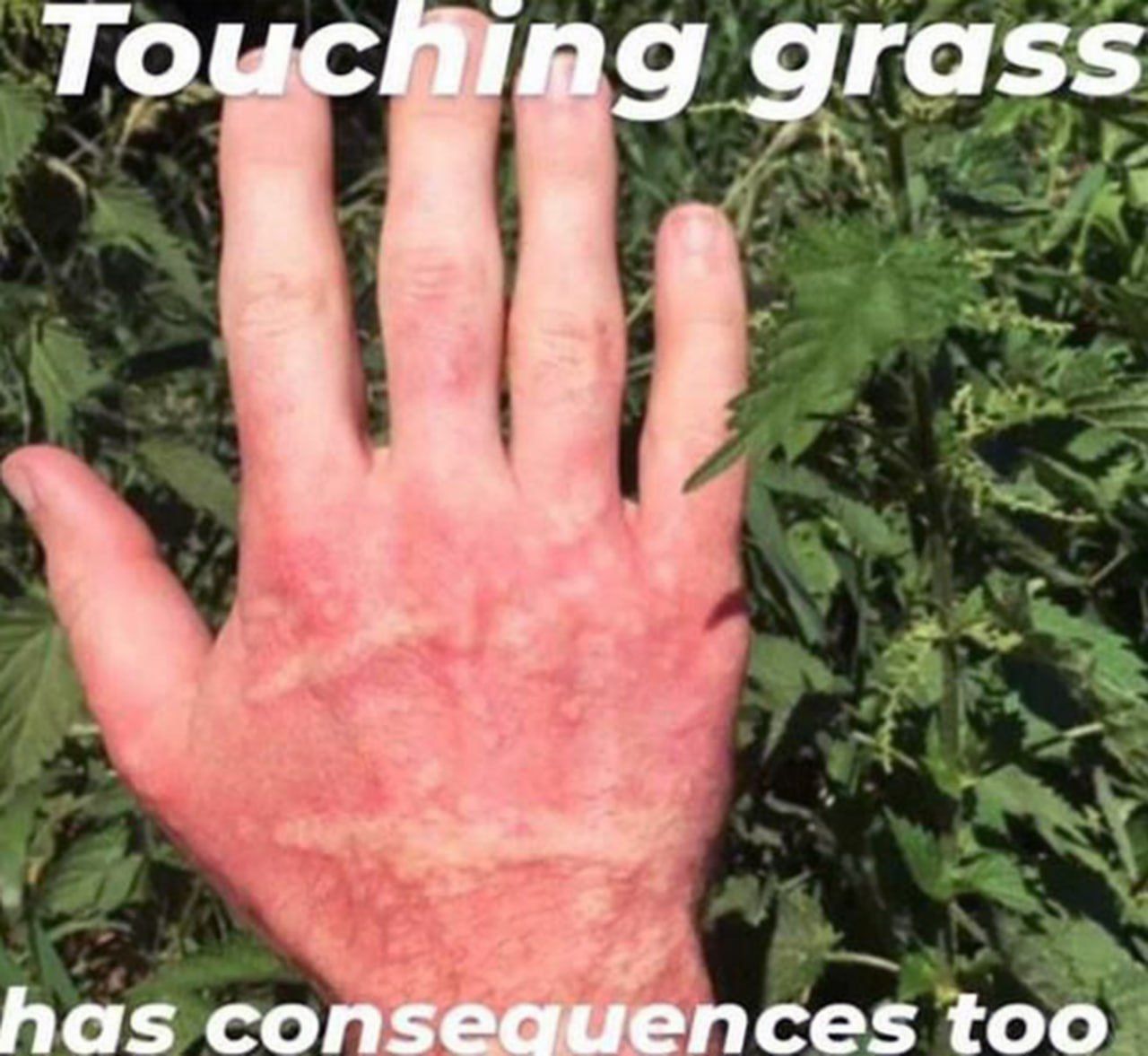 "Touch grass" they said...