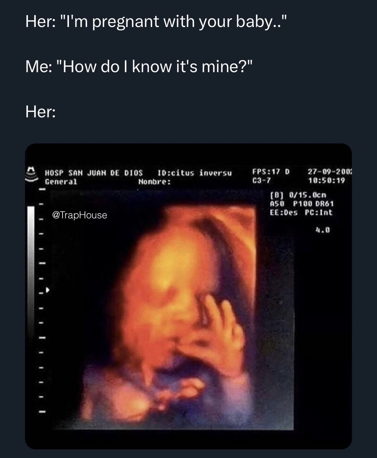 Ayyyyyy