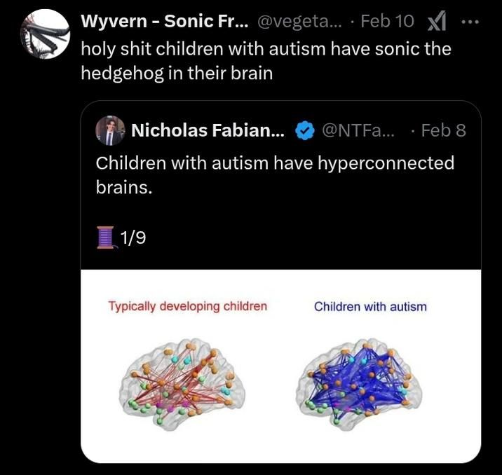 autism is when the brain connections are blue instead of red