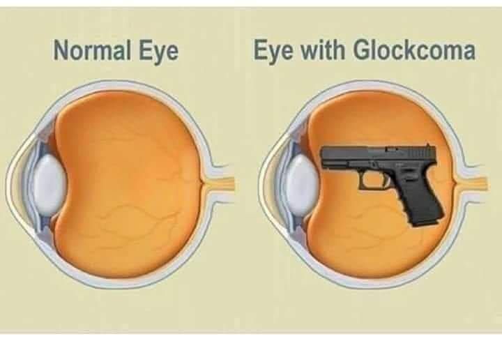 Looking at you