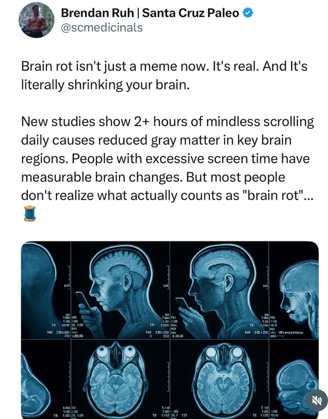 ​​​