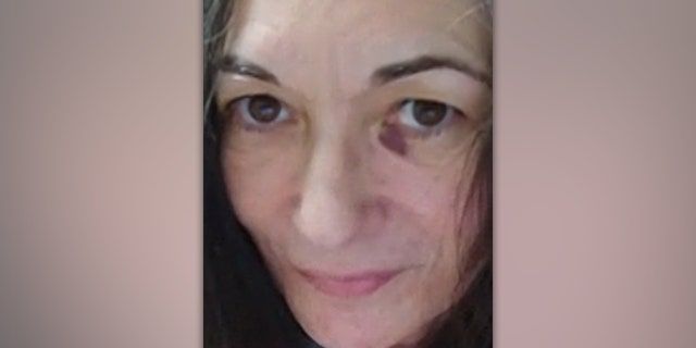 What exactly is she trying to say with the black eye?