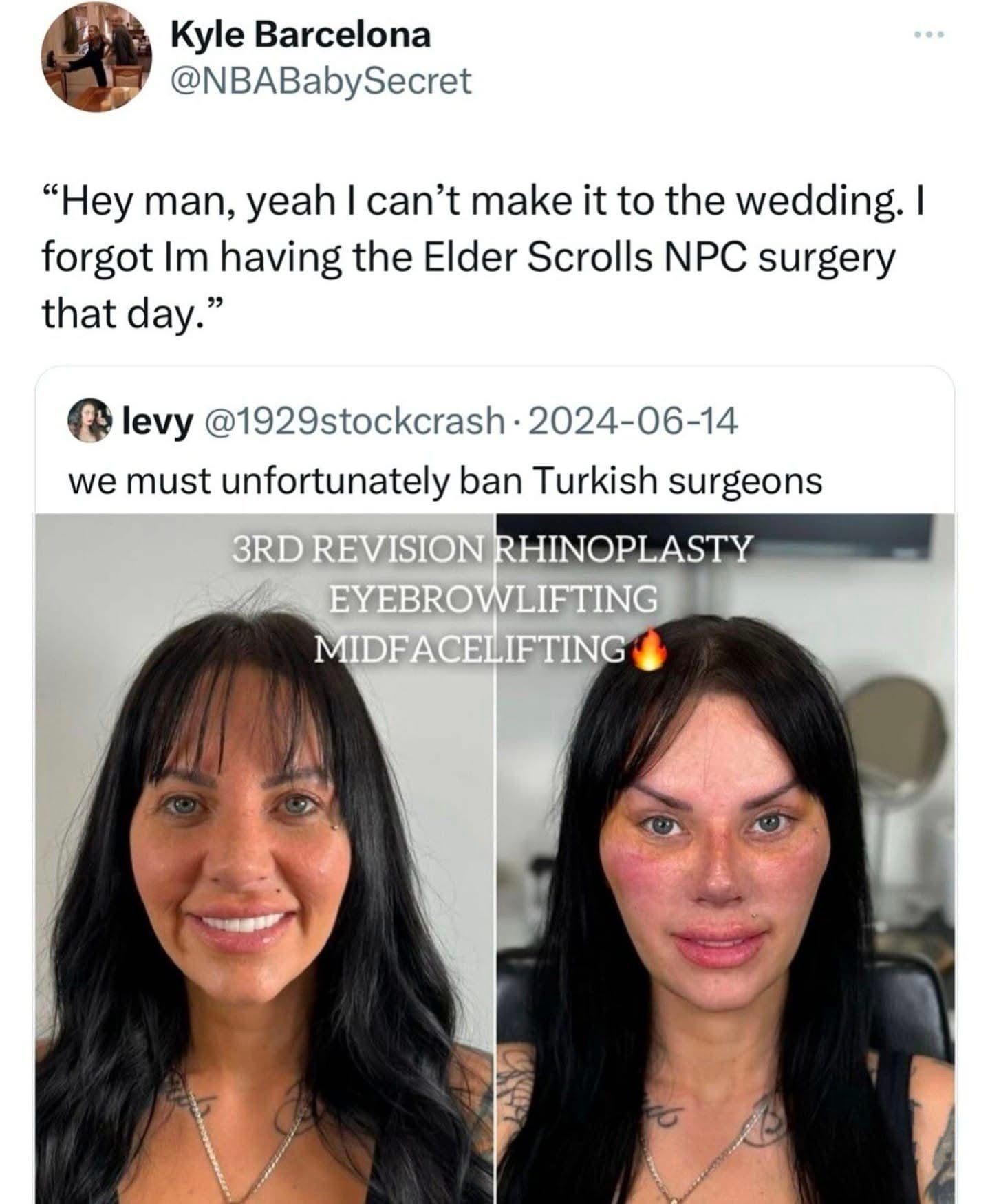 Life imitates elders scrolls