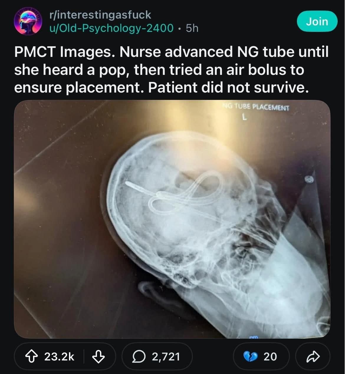 Oopsie! I'm such a gemini