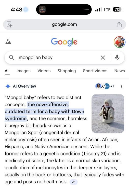 Gemini teaching new slurs