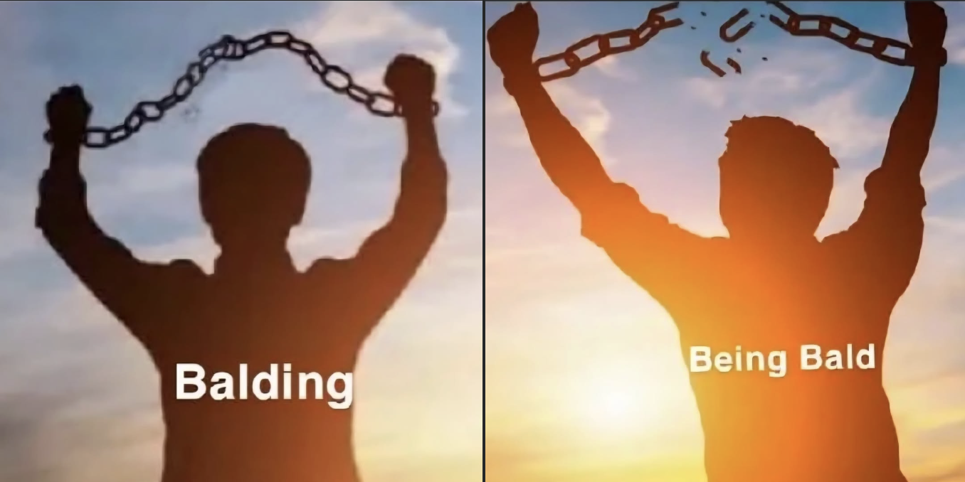 I've gotten as much (if not more) compliments after going bald as I did when I had full hair